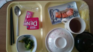 アレルギー 歯周病 ポケット 埋没型：親不知 親知らず 抜歯手術 入院 麻酔 静脈 全身 不安 痛い 腫れ 抗生物質 点滴