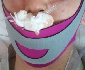 親不知 抜歯手術 口腔外科 事前検査 血液検査 CTスキャン レントゲン 唇の痺れ 麻痺 同意書 書類 入院の手引き 費用 手術台 保険 